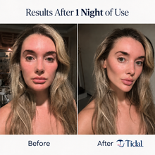 Before and after one night of use