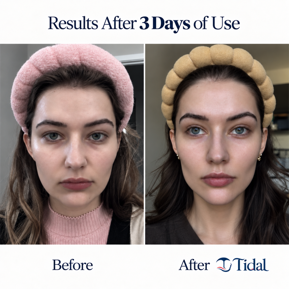 Before and after three days of use