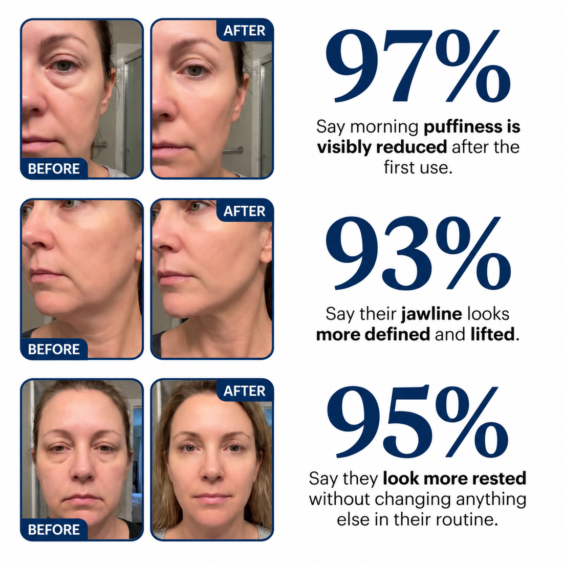 97% say morning puffiness is visibly reduced, 93% say their jawline looks more defined and lifted, 95% say they look more rested